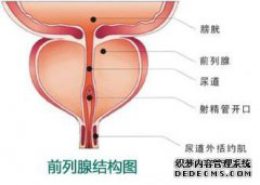 前列腺炎怎么治療?